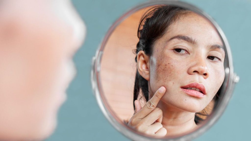 8 Best Face Wash For Hyperpigmentation: Grab One For You!